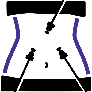 Laparoscopy